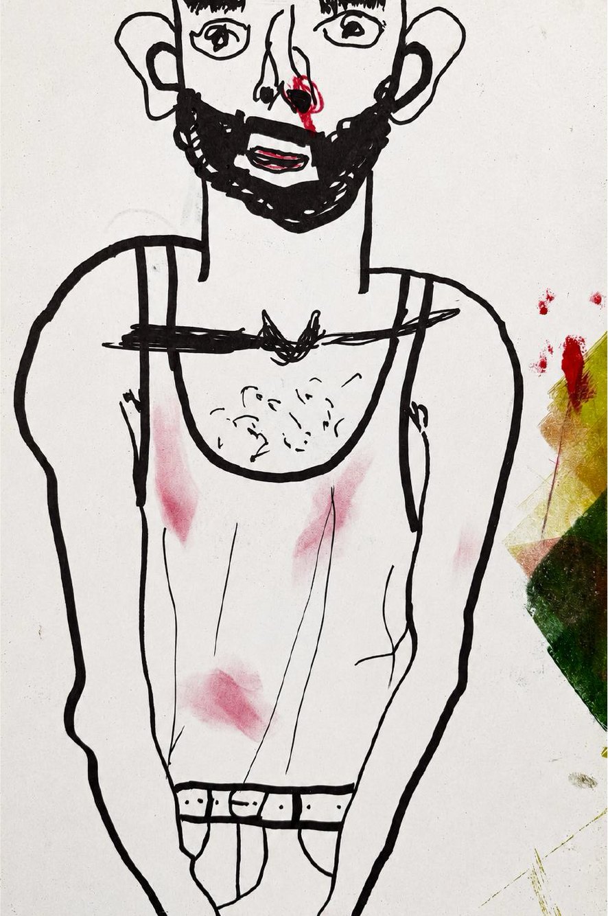 Bleeding